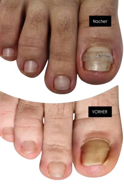 Vorher / Nachher
